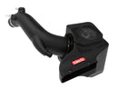 AFE Takeda Momentum Cold Air Intake System w/Pro DRY S Filter Hyundai Veloster N 19-20-4
