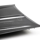 Anderson Composites 17-19 Chevrolet Colorado ZR2 Type-OE Carbon Fiber Hood-5