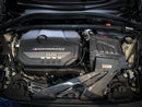 F40 M135 (B48) carbon fiber intake  (alloy base + carbon fiber cover)-2